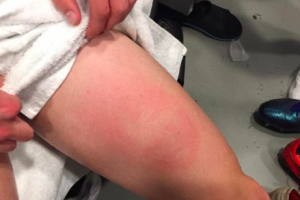 FOTO/Il Napoli commenta su Twitter l’ammonizione di Fabian Ruiz item-thumbnail