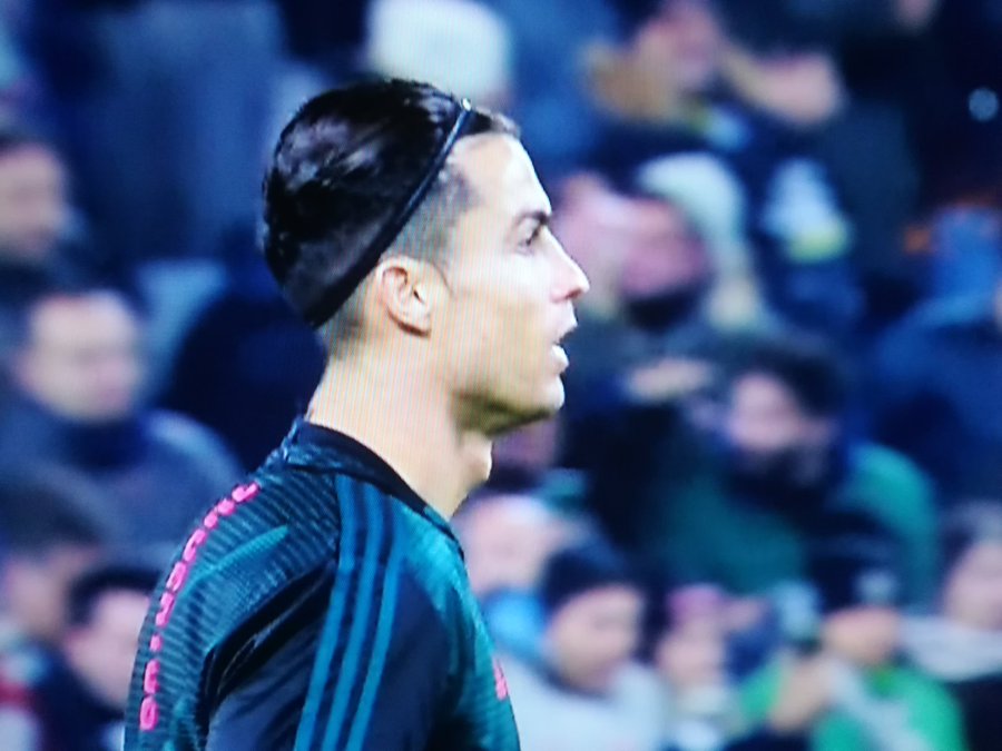 Biasin: la difesa di Ronaldo è stucchevole e molto poco juventina. Il maltrattato Immobile è meglio di lui Biasin: la difesa di Ronaldo è stucchevole e molto poco juventina. Il maltrattato Immobile è meglio di lui