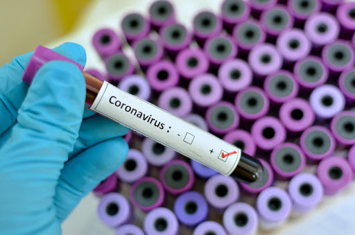 I dati dell’epidemia in Italia: 3815 nuovi positivi e 756 decessi