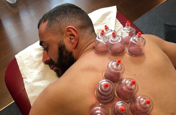 Cosa sono quelle bolle sulla schiena di Benzema? La Hijama, la terapia olistica con le ventose Cosa sono quelle bolle sulla schiena di Benzema? La Hijama, la terapia olistica con le ventose