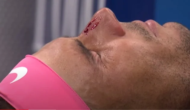 Nadal