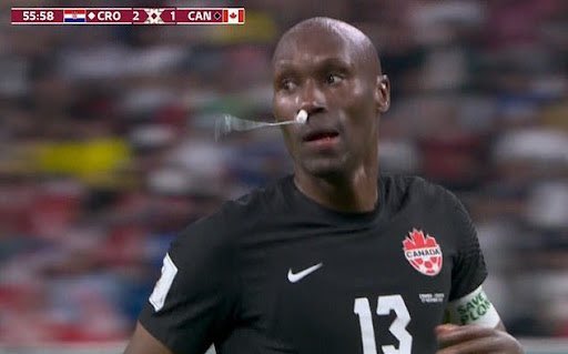 Canada, il tampone nel naso di Hutchinson solletica l’ironia dei social Canada, il tampone nel naso di Hutchinson solletica l’ironia dei social