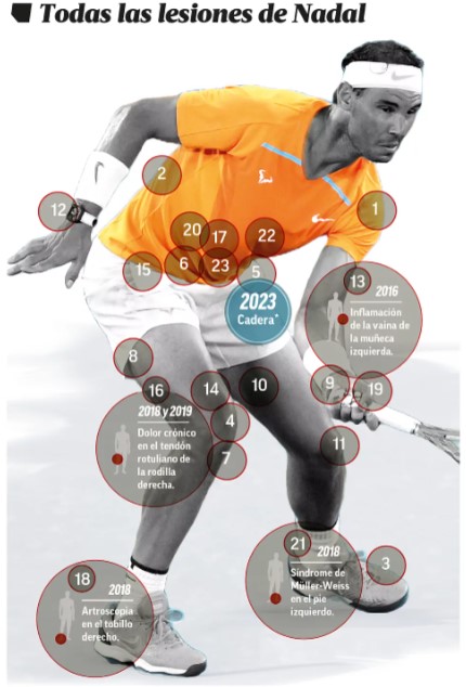 Nadal