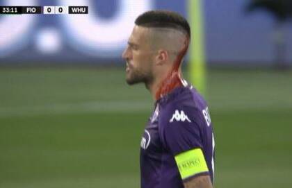 Biraghi ferito alla testa da un oggetto lanciato in campo dai tifosi del West Ham Biraghi ferito alla testa da un oggetto lanciato in campo dai tifosi del West Ham