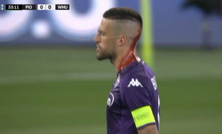 Biraghi ferito alla testa da un oggetto lanciato in campo dai tifosi del West Ham  