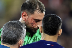 Donnarumma ha la faccia devastata, immagini choc. Le Parisien: “Singo non è stato nemmeno ammonito” item-thumbnail